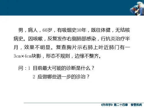 食管癌-PPT课件
