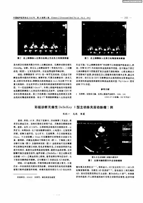 彩超诊断无痛性DeBeKeyⅠ型主动脉夹层动脉瘤1例