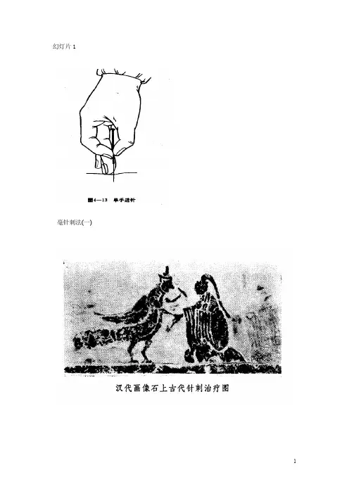 (针灸)毫针刺法  图文讲义汇编