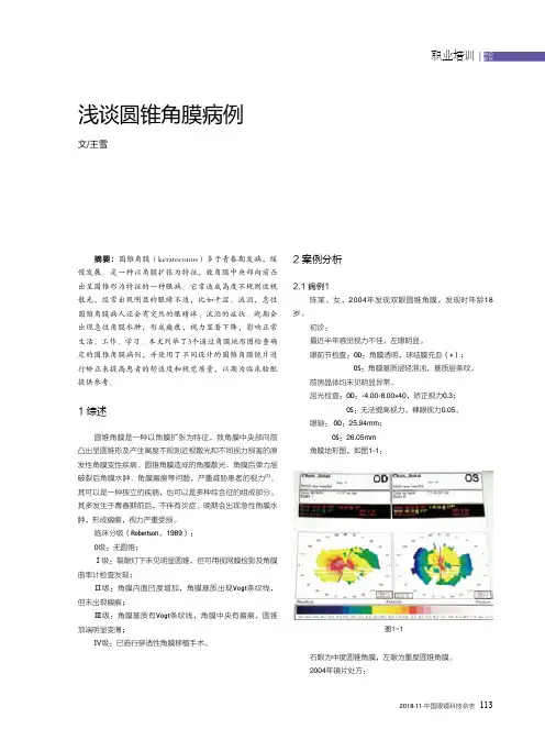浅谈圆锥角膜病例