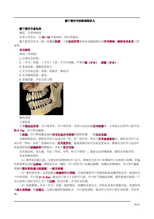 颞下颌关节疾病课程讲义