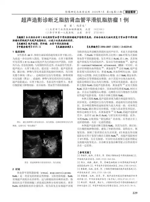 超声造影诊断乏脂肪肾血管平滑肌脂肪瘤1例