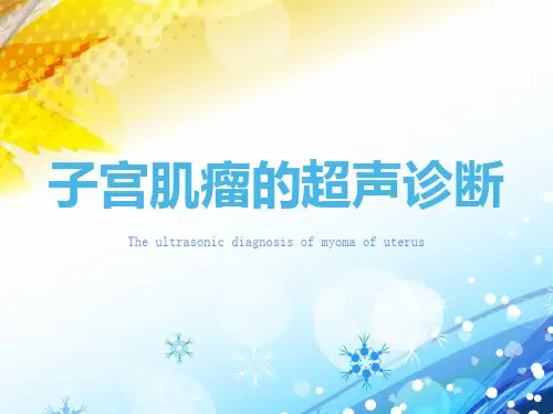 子宫肌瘤的超声诊断【超声诊断学课件】