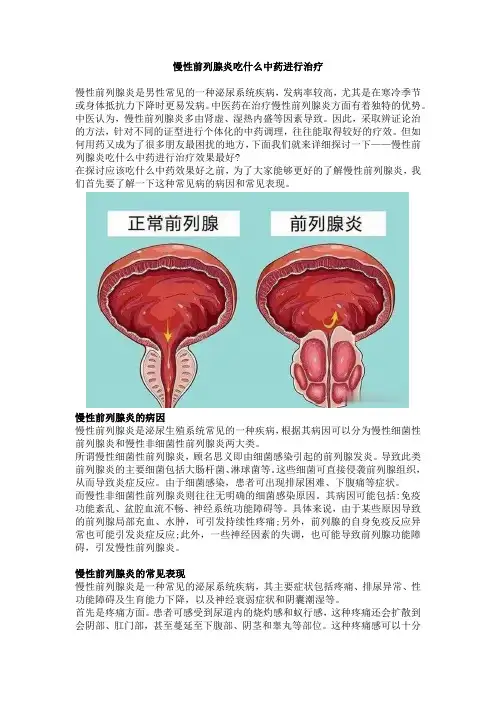 慢性前列腺炎吃什么中药进行治疗