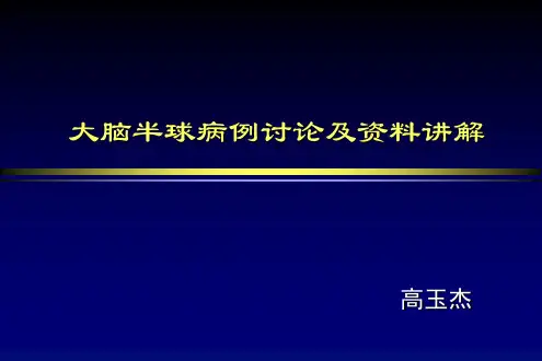 脑胶质瘤诊断及鉴别