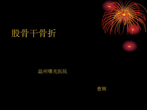股骨干骨折