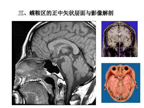 人体断面与影像解剖学头部之四
