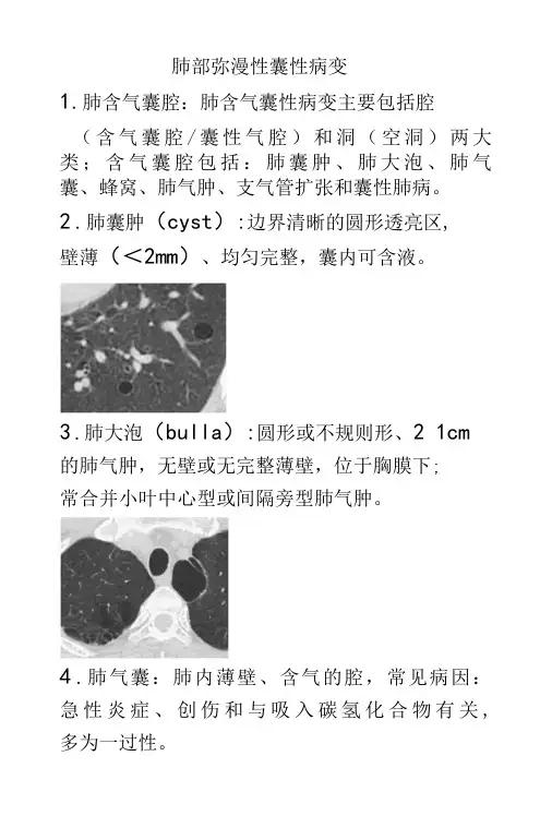 肺部弥漫性囊性病变影像诊断