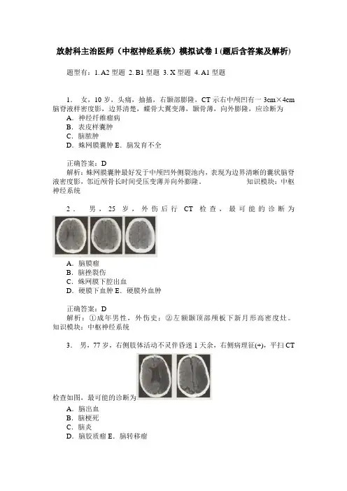 放射科主治医师(中枢神经系统)模拟试卷1(题后含答案及解析)