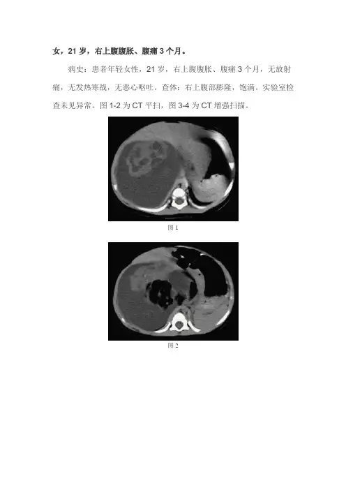 肝脏畸胎瘤