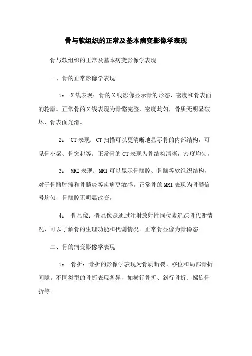 骨与软组织的正常及基本病变影像学表现