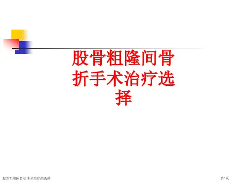 股骨粗隆间骨折手术治疗的选择