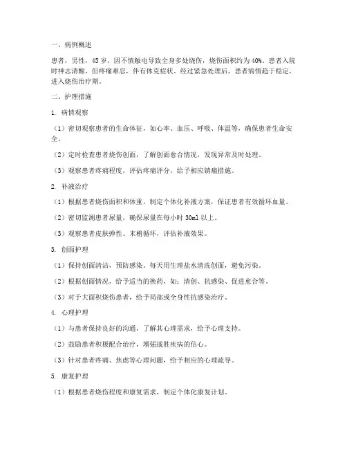 烧伤个案护理总结范文
