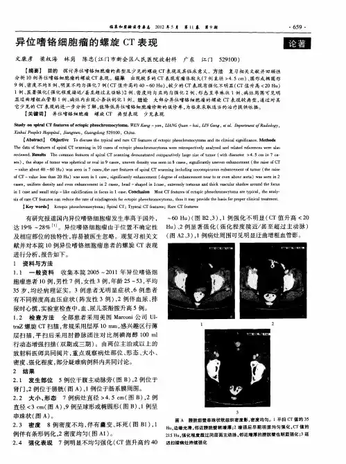 异位嗜铬细胞瘤的螺旋CT表现
