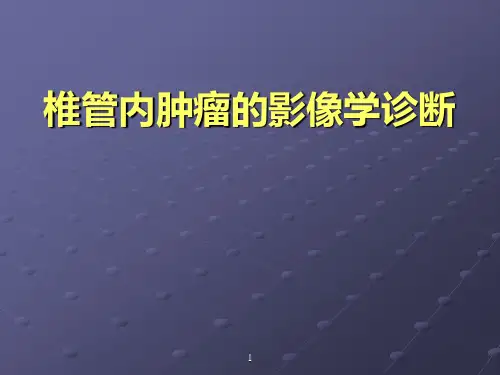 椎管内肿瘤CTMRI诊断PPT课件