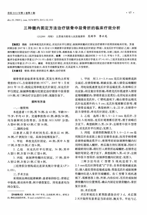 三种髓内固定方法治疗锁骨中段骨折的临床疗效分析