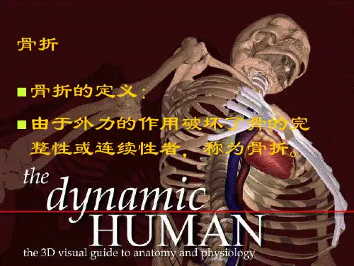 骨折的内固定