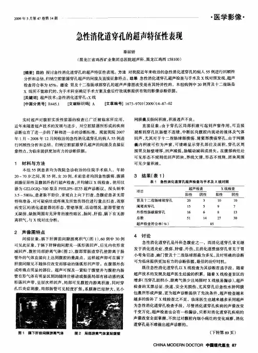 急性消化道穿孔的超声特征性表现