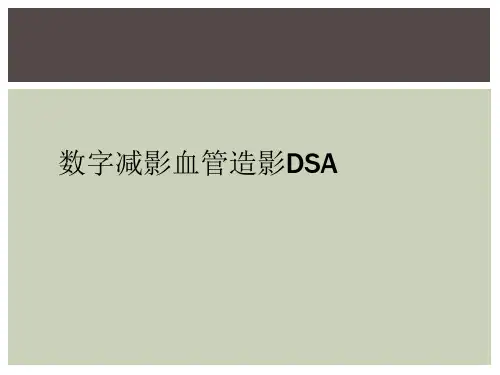 数字减影血管造影DSA