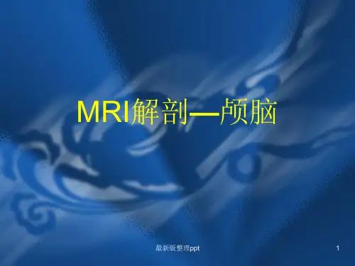 MRI解剖—颅脑ppt课件