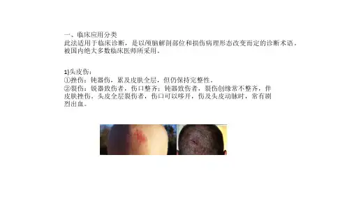 26颅脑创伤的分类
