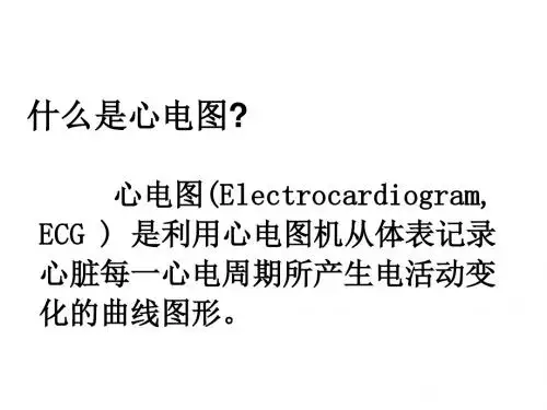 临床心电图分析ppt课件