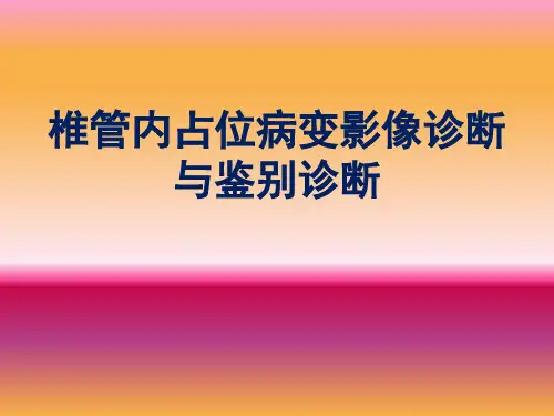 椎管内占位病变影像诊断与鉴别诊断