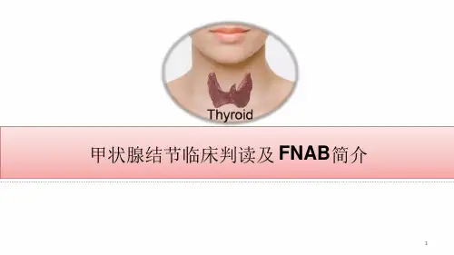 甲状腺结节彩超判读及细针穿刺参考幻灯片