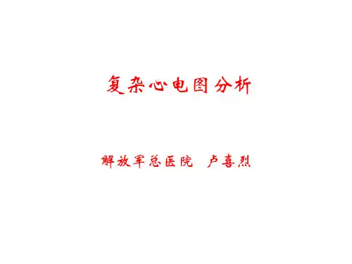 复杂心电图分析