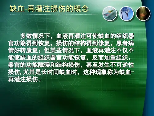 缺血再灌注损伤课件