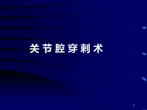 关节穿刺术