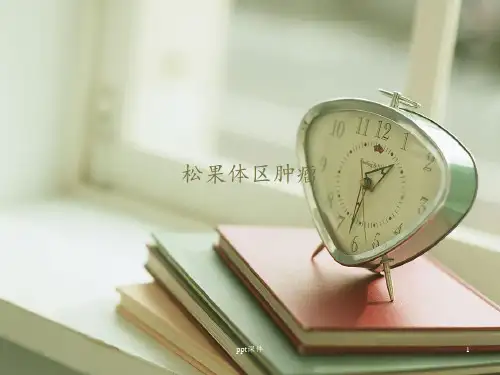 松果体肿瘤 ppt课件