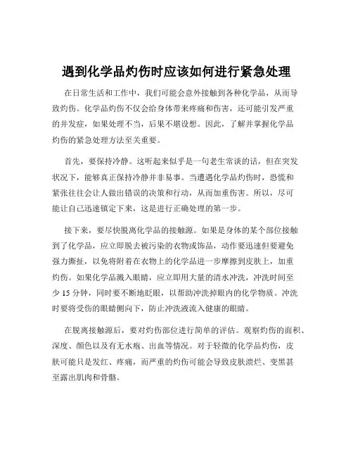 遇到化学品灼伤时应该如何进行紧急处理