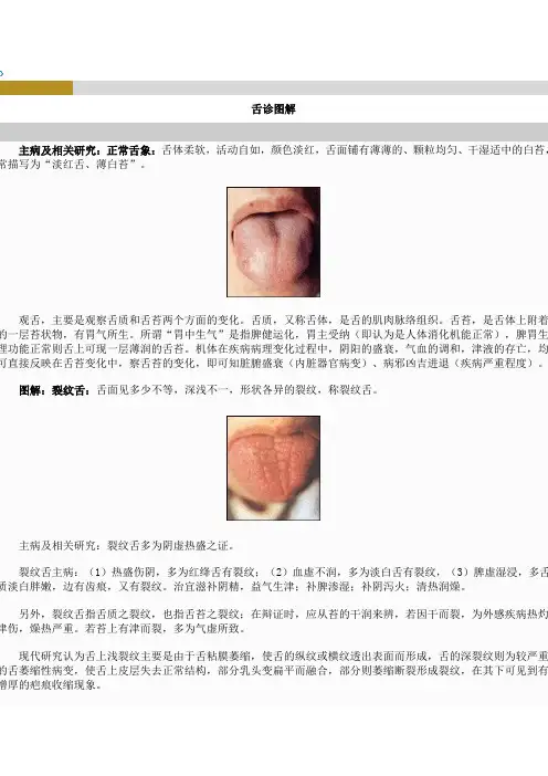 舌诊图解