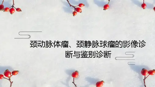 颈动脉体瘤、颈静脉球瘤的影像诊断与鉴别诊断
