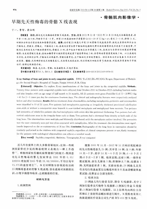 早期先天性梅毒的骨骼X线表现