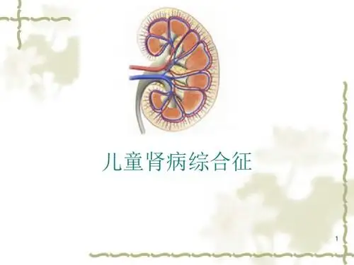 儿科肾病综合症ppt课件