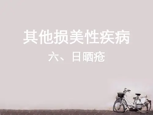 美容中医学--日晒疮牛皮癣粉花疮  ppt课件