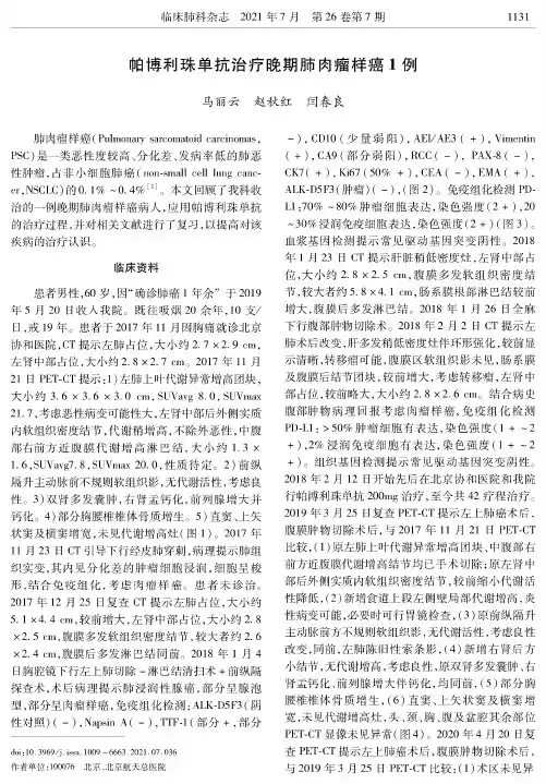 帕博利珠单抗治疗晚期肺肉瘤样癌1例