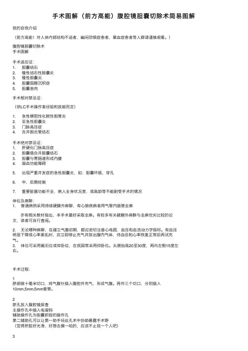 手术图解（前方高能）腹腔镜胆囊切除术简易图解