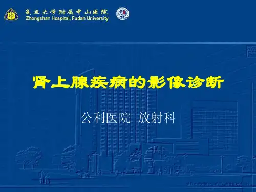 肾上腺疾病的影像诊断