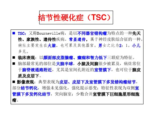 结节性硬化症 ppt课件