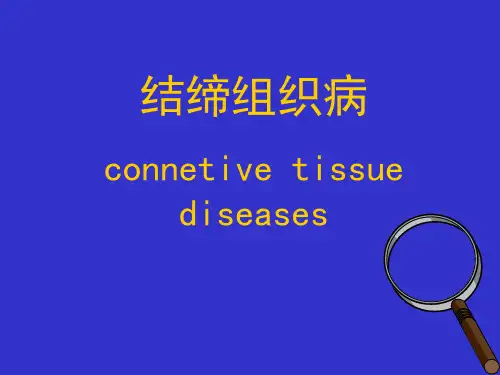 --医学PPT课件结缔组织病
