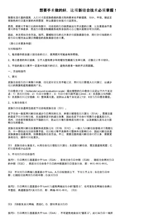 想要手术做的好，这项新缝合技术必须掌握！