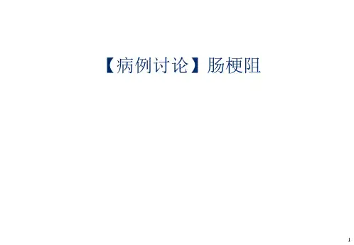 病例讨论肠梗阻