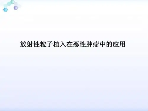 放射性粒子植入技术