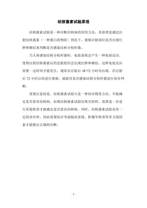 结核菌素试验原理