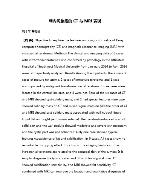 颅内畸胎瘤的CT与MRI表现