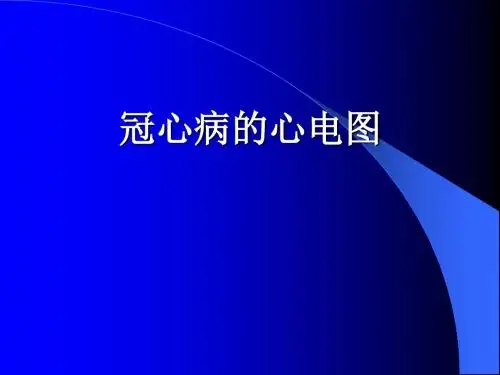 冠心病的心电图1