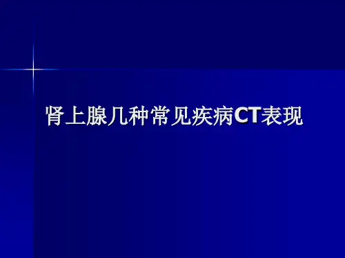肾上腺几种常见疾病CT表现